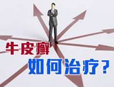 治療牛皮癬需謹(jǐn)慎