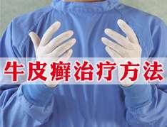 治療牛皮癬要從生活常識(shí)開始